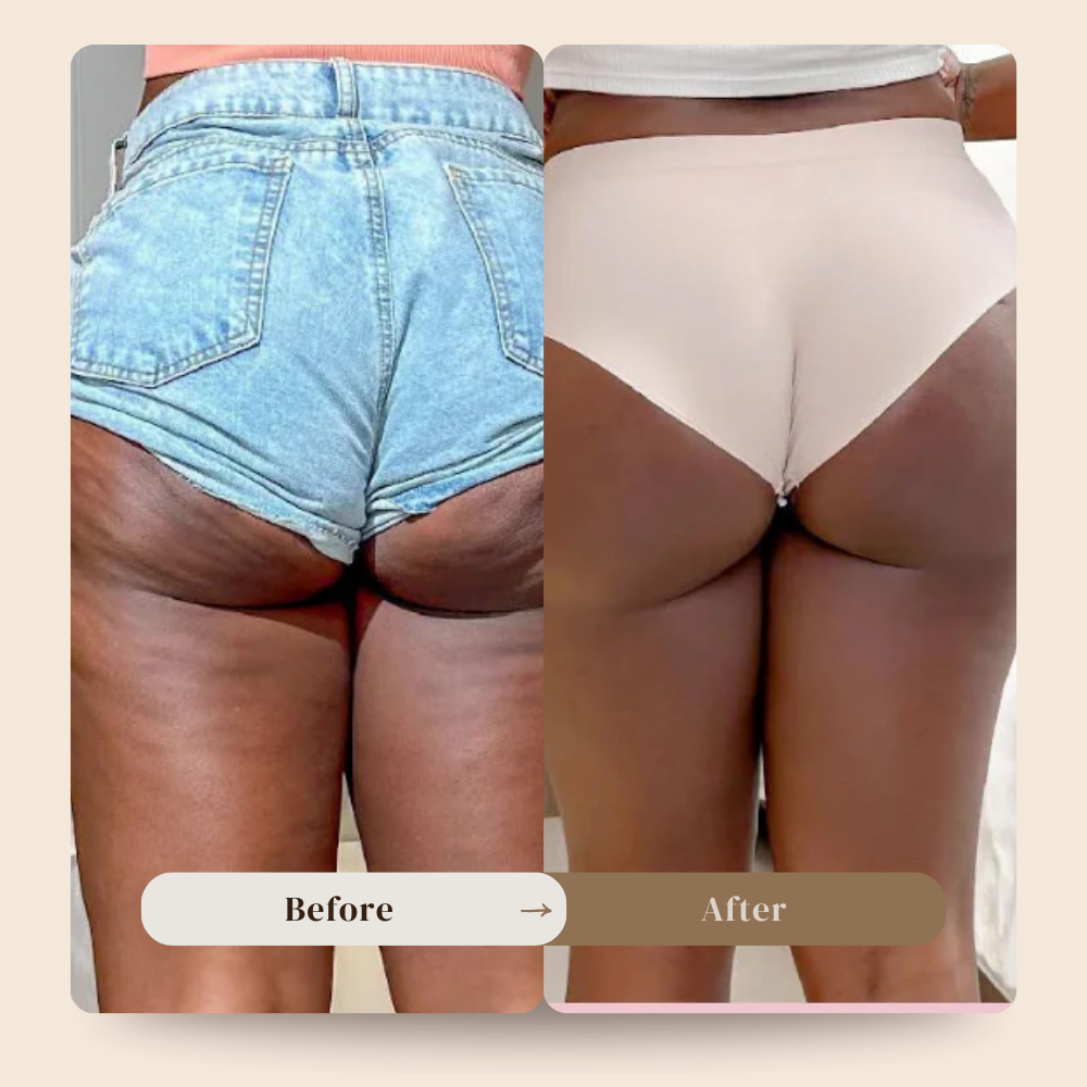 Anti cellulite massager