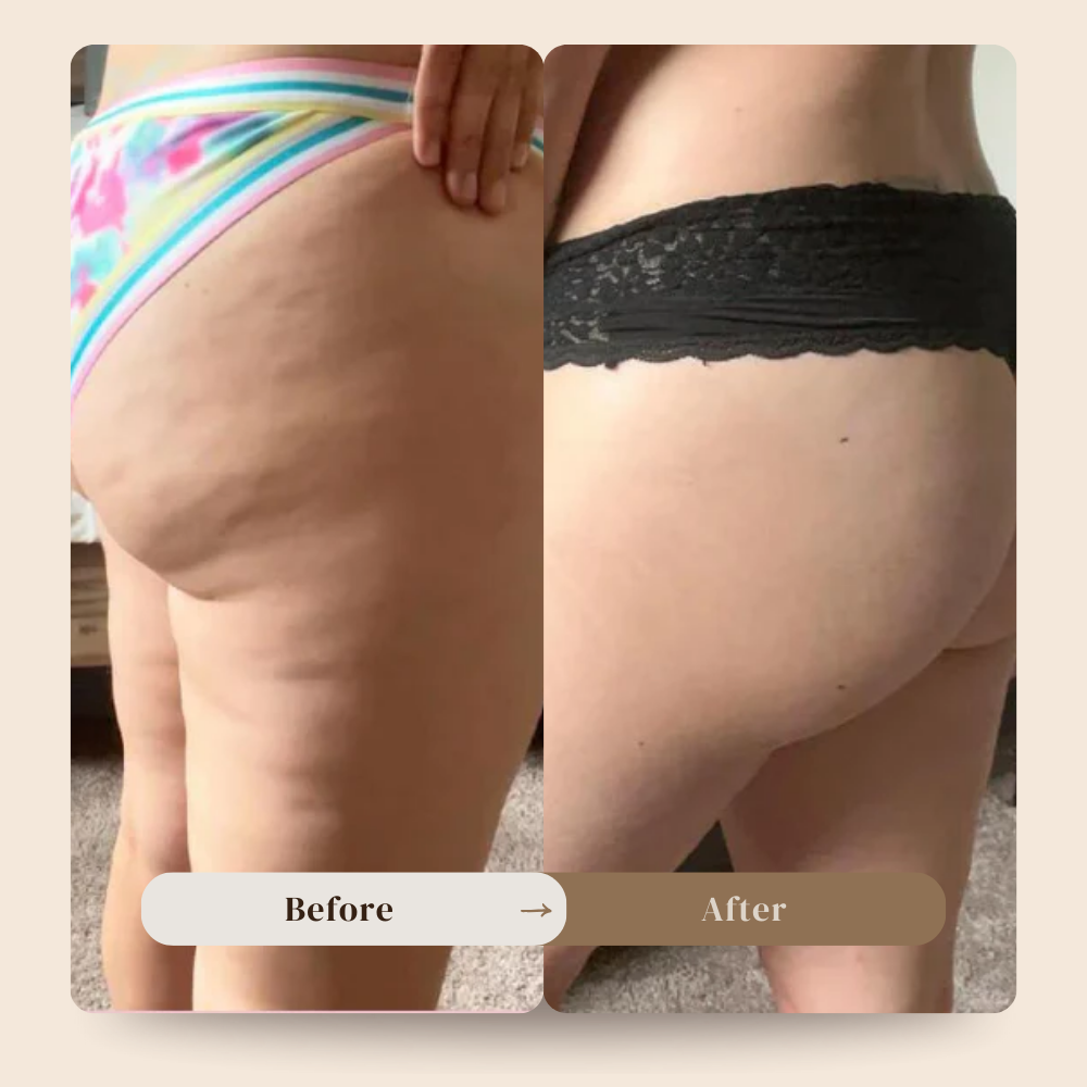 Anti cellulite massager