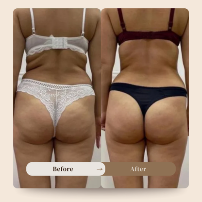Anti cellulite massager