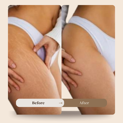 Anti cellulite massager